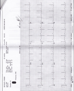 41689 Rapport bidon du CSSSTR 15 de 20 S